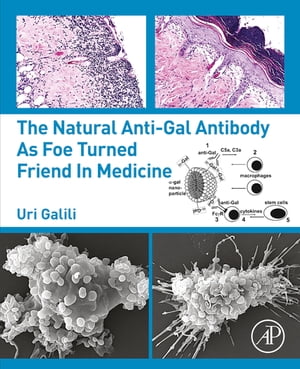 ŷKoboŻҽҥȥ㤨The Natural Anti-Gal Antibody as Foe Turned Friend in MedicineŻҽҡ[ Uri Galili ]פβǤʤ10,569ߤˤʤޤ