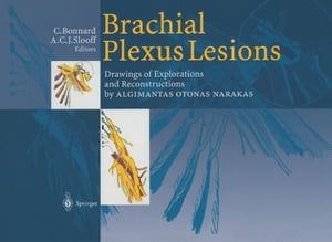 Brachial Plexus Lesions