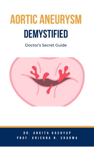 Aortic Aneurysm Demystified: Doctor’s Secret Guide