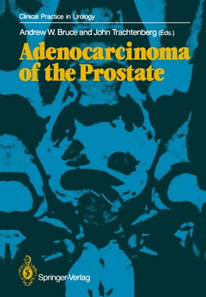 ŷKoboŻҽҥȥ㤨Adenocarcinoma of the ProstateŻҽҡۡפβǤʤ6,076ߤˤʤޤ