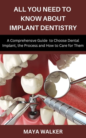 ALL YOU NEED TO KNOW ABOUT IMPLANT DENTISTRY