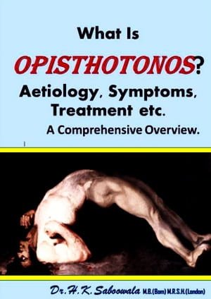 What Is Opisthotonos? Aetiology, Symptoms, Treatment etc. A Comprehensive Overview