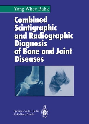 Combined Scintigraphic and Radiographic Diagnosis of Bone and Joint Diseases