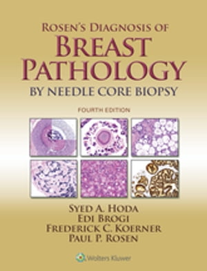 Rosen 039 s Diagnosis of Breast Pathology by Needle Core Biopsy【電子書籍】 Syed A. Hoda