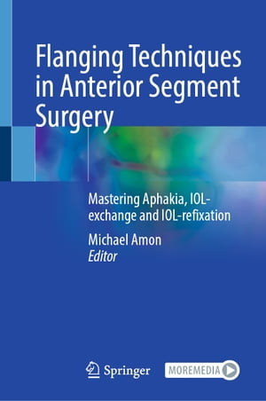 Flanging Techniques in Anterior Segment Surgery Mastering Aphakia, IOL-exchange and IOL-refixation