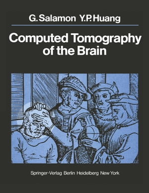 Computed Tomography of the Brain