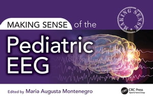 Making Sense of the Pediatric EEG