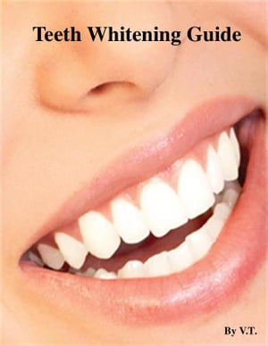 Teeth Whitening Guide