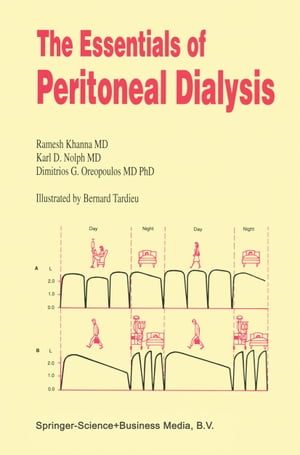 The Essentials of Peritoneal Dialysis