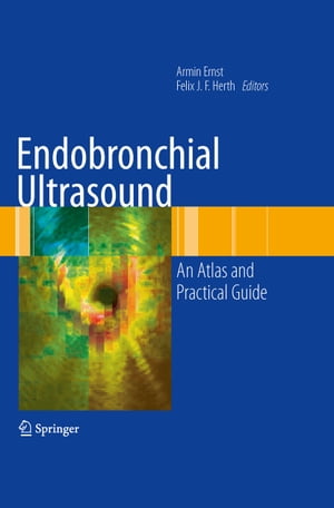 Endobronchial Ultrasound