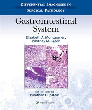 Differential Diagnoses in Surgical Pathology: Gastrointestinal System