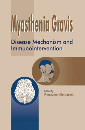 Myasthenia Gravis Disease Mechanism and Immunoin