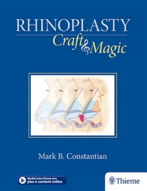 Rhinoplasty