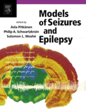 Models of Seizures and Epilepsy