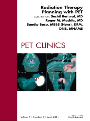 Radiation Therapy Planning, An Issue of PET Clinics Radiation Therapy Planning, An Issue of PET Clinics【電子書籍】 Sushil Beriwal, MD