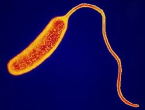 Cholera: Causes, Symptoms and Treatments