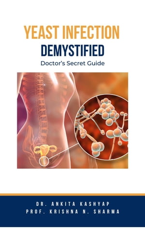 Yeast Infection: Demystified Doctor’s Secret Guide