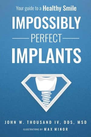 Impossibly Perfect Implants