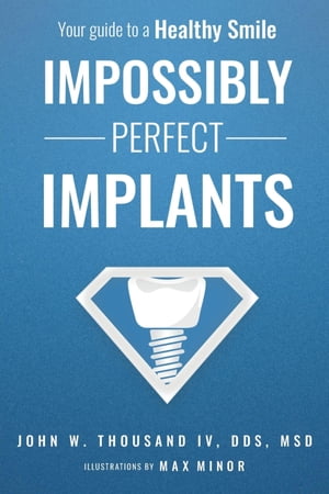 ŷKoboŻҽҥȥ㤨Impossibly Perfect Implants Your guide to a Healthy SmileŻҽҡ[ John W. Thousand ]פβǤʤ1,383ߤˤʤޤ