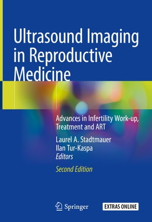 Ultrasound Imaging in Reproductive Medicine Advances in Infertility Work-up, Treatment and ART【電子書籍】