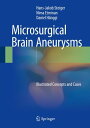 Microsurgical Brain Aneurysms Illustrated Concepts and Cases【電子書籍】[ Nima Etminan...