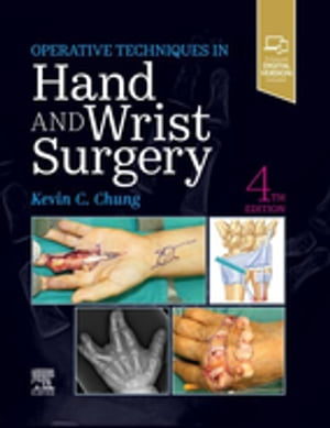 Operative Techniques: Hand and Wrist Surgery E-Book