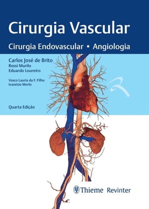 Cirurgia Vascular