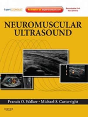 Neuromuscular Ultrasound