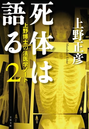 死体は語る２　上野博士の法医学ノート