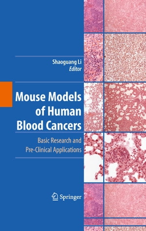 Mouse Models of Human Blood Cancers