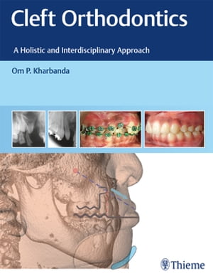 Cleft Orthodontics