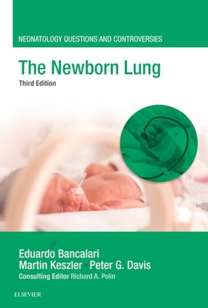 The Newborn Lung