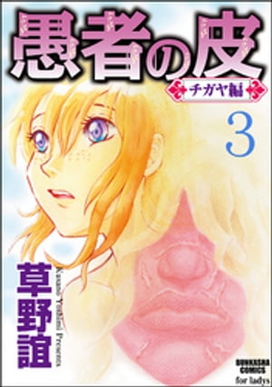 愚者の皮ーチガヤ編ー（分冊版） 【第3話】 永訣