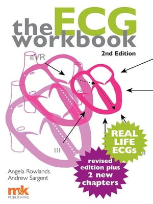 ECG Workbook 2/e