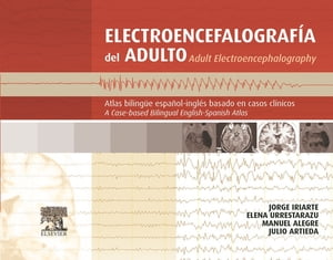 Electroencefalografía del adulto