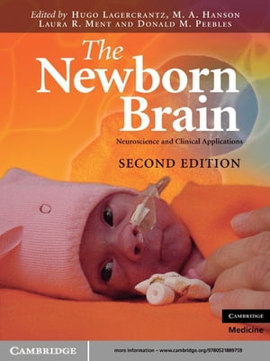 The Newborn Brain