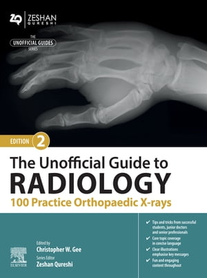 The Unofficial Guide to Radiology: 100 Practice Orthopaedic X-rays