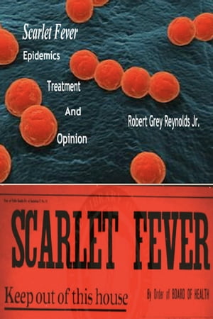 Scarlet Fever Epidemics Treatment And Opinion