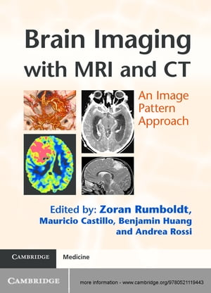 Brain Imaging with MRI and CT