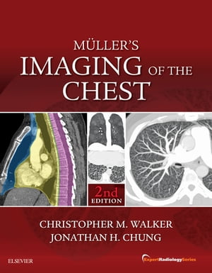 Muller's Imaging of the Chest E-Book Expert Radiology Series【電子書籍】[ Christopher M. Walker ]