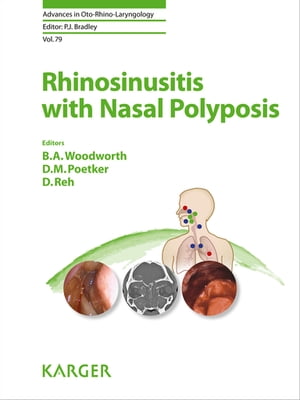 Rhinosinusitis with Nasal Polyposis With a foreword by D.W. Kennedy (P...