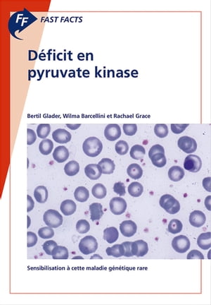Fast Facts: Déficit en pyruvate kinase
