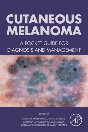 Cutaneous Melanoma A Pocket Guide for Diagnosis and Management