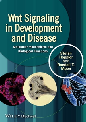 Wnt Signaling in Development and Disease Molecular Mechanisms and Biological Functions