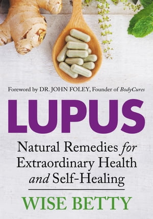 Lupus