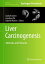 Liver Carcinogenesis