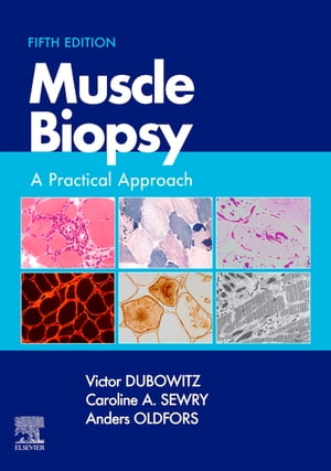 Muscle Biopsy