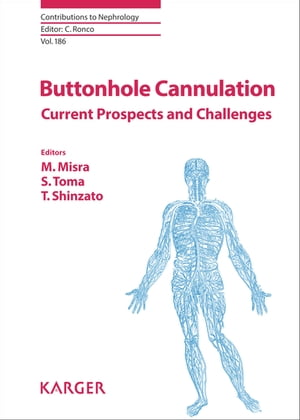 Buttonhole Cannulation Current Prospects and ChallengesŻҽҡ[ Claudio...