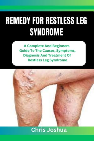 REMEDY FOR RESTLESS LEG SYNDROME A Complete And Beginners Guide To The Causes, Symptoms, Diagnosis And Treatment Of Restless Leg Syndrome