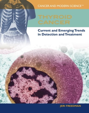 Thyroid Cancer